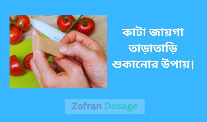 কাটা জায়গা তাড়াতাড়ি শুকানোর উপায়